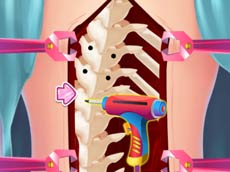 Anna Scoliosis Surgery